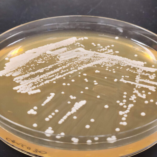 A closeup photo of yeast colonies in Crook’s lab.